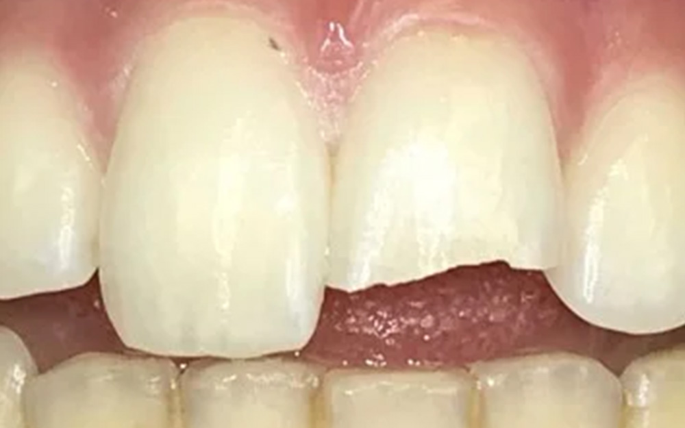 Before treatment