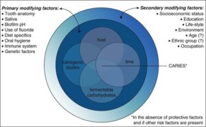 , Prevention Of Dental Decay