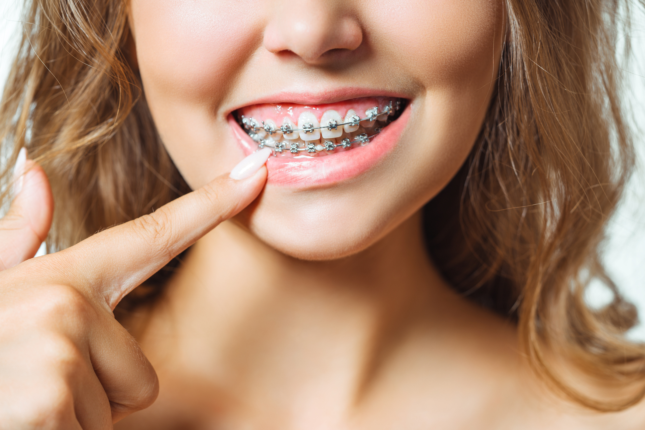 , Orthodontics in Kidlington: Your guide to a straight smile