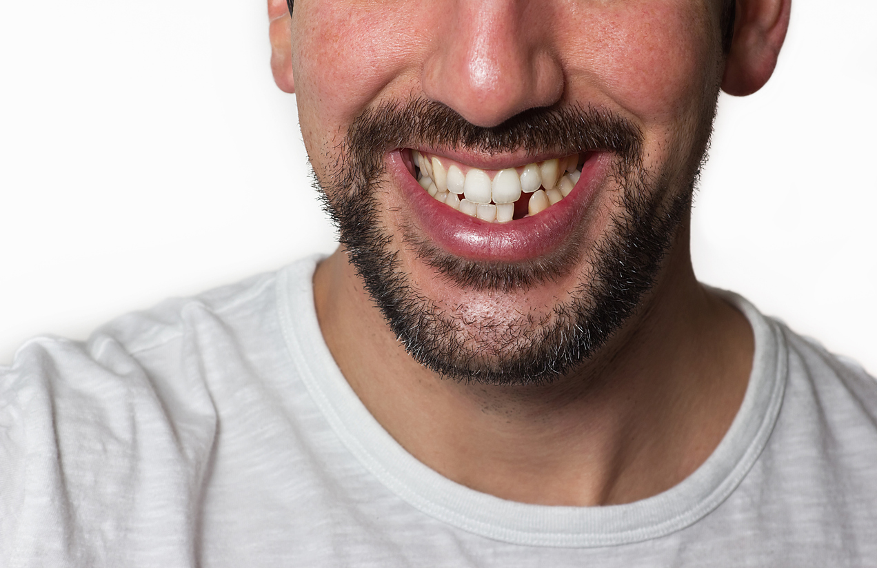 , Regain your confidence: The impact of missing teeth and how we can help in Kidlington
