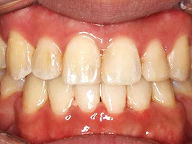 Case 18 After