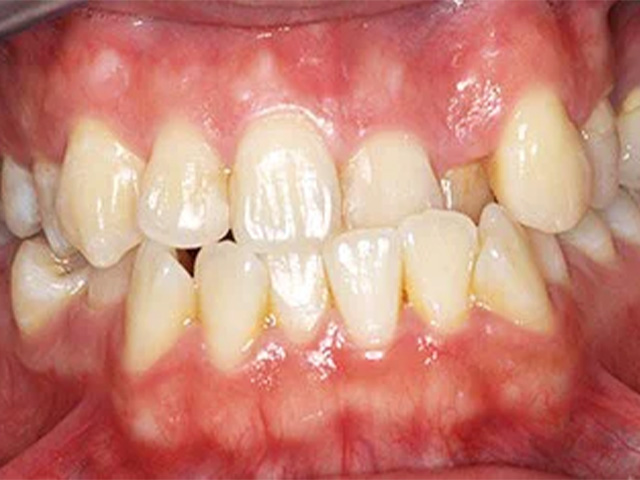 Case 18 Before